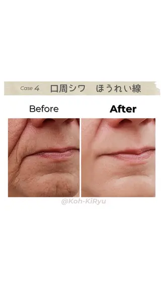 体質改善✨美肌育サロ ン 香嬉琉🌿きよかのエステ・リラクイメージ