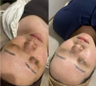 LUMIERE(ルミエル)福岡春吉店所属・LUMIERE 福岡のエステ・リラクイメージ