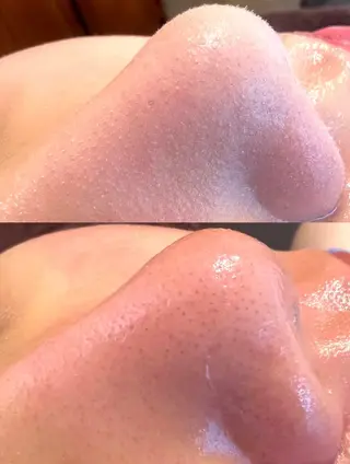 艶肌wax®︎ shocoのエステ・リラクイメージ