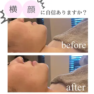 小顔・リフトアップ/ 奈緒美のエステ・リラクイメージ