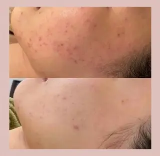 April EstheSalonのエステ・リラクイメージ