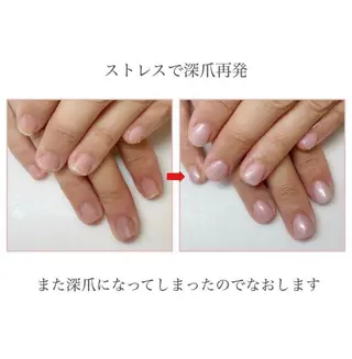 ネイル ネイルサロン アリュームのネイルデザイン