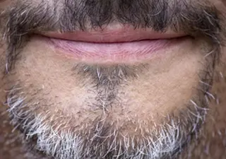 Men'sエステ/ メンズ脱毛ツインズのエステ・リラクイメージ