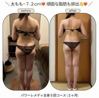 《本気痩せ×疲労改善 》  BILOOPのエステ・リラクイメージ