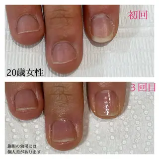 ネイル 自爪育成専門サロン エムロードゥ池下のネイルデザイン