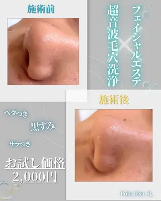 南船場/心斎橋 エステ/Maruのエステ・リラクイメージ