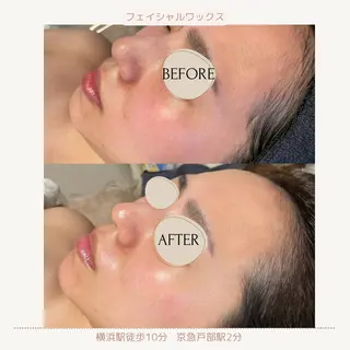 代表 MOMOのエステ・リラクイメージ