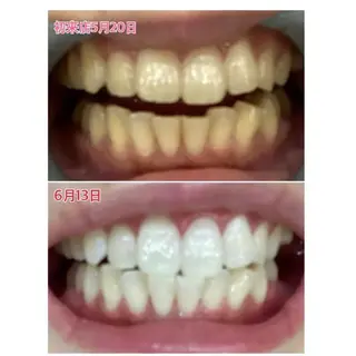 Ｍ渋谷 ホワイトニングのエステ・リラクイメージ