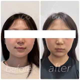 小顔と ヘッドスパのお店のエステ・リラクイメージ