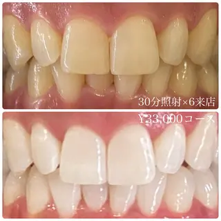 メンズ ホワイトニング ルーム　川崎店のその他イメージ