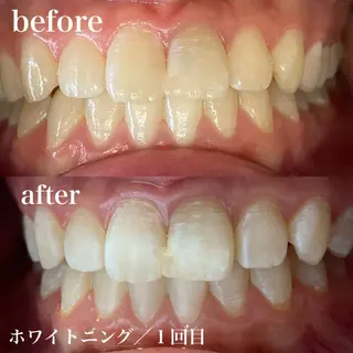 磐田｜LAYLA 一番丁寧な脱毛店のエステ・リラクイメージ