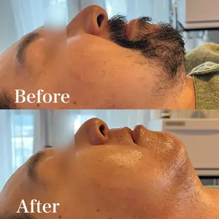 メンズ wax脱毛専門店 ハイラントのエステ・リラクイメージ