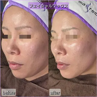 facial salon Lily所属・salon Lilyのエステ・リラクイメージ