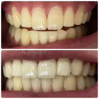 メンズ LOVEホワイト ニング恵比寿店のその他イメージ