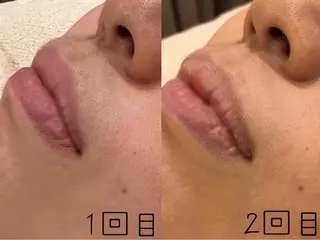 ULULU 上野店のエステ・リラクイメージ