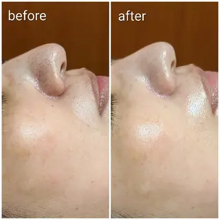 顔ツボ整顔セラピスト 三根百恵のエステ・リラクイメージ