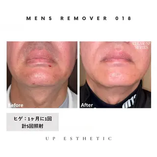 メンズ 韓国肌管理 ウプエステティックのエステ・リラクイメージ