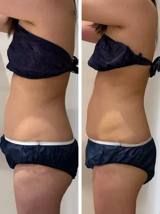 東大阪/韓国肌管理/ 痩身バスト専門店のエステ・リラクイメージ