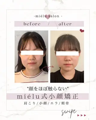 小顔矯正|痩身 miélusalonのエステ・リラクイメージ