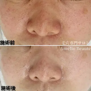 毛穴ケア専門サロン アメリオボーテのその他イメージ