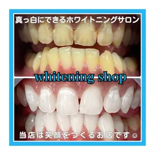 ホワイトニング ショップ浦和店のその他イメージ