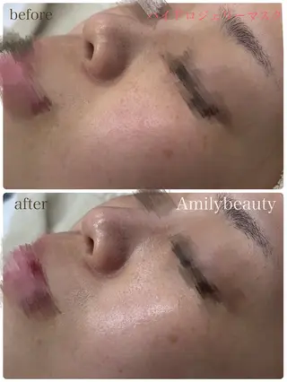 Amily beauty 毛利のエステ・リラクイメージ