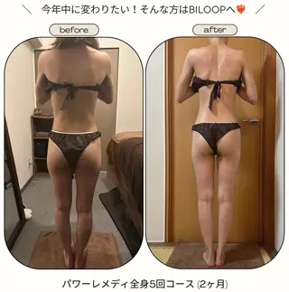 《本気痩せ×疲労改善 》  BILOOPのエステ・リラクイメージ