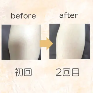 脱毛専門店 Angemのエステ・リラクイメージ