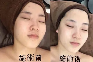 マツエク・マツパ aliaハーブ水光店 エステティシャン募集のエステ・リラクイメージ