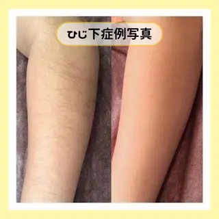 金山/脱毛/美肌 ULULUのエステ・リラクイメージ