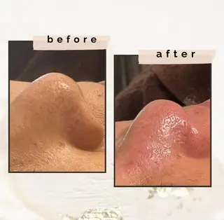 腸もみ・メンズ脱毛・ 毛穴洗浄〜カナロア〜のエステ・リラクイメージ