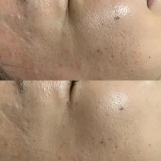 小顔専門店 桜Bisucuitのエステ・リラクイメージ