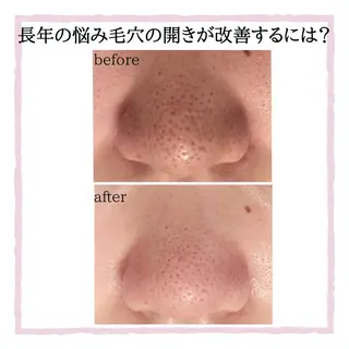毛穴・シミ専門サロン ルパークのエステ・リラクイメージ