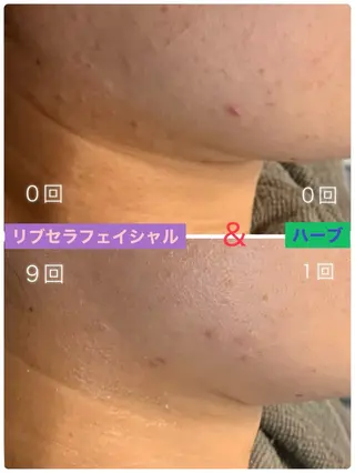 プライベートサロン プリュネルのエステ・リラクイメージ