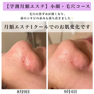 Bellesthe (ベルエステ)のエステ・リラクイメージ