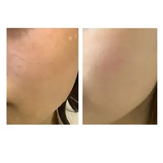 メンズ 大阪脱毛|ちぇるま| 眉毛Wax｜美肌管理のエステ・リラクイメージ