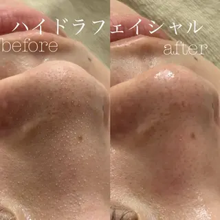 フェイシャルサロン CHIARA 荒田のエステ・リラクイメージ