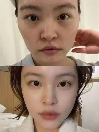 マツエク・マツパ aliaハーブ水光店 エステティシャン募集のエステ・リラクイメージ