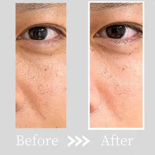 小顔・ツルツル素肌 ハリステリアのエステ・リラクイメージ