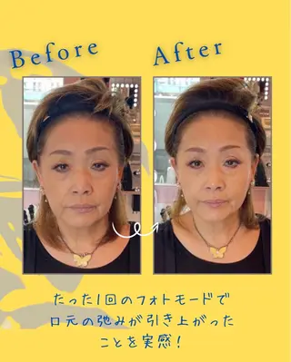 ヘアサロンLISALISA所属・セルフ脱毛・光エステ LISALISAのエステ・リラクイメージ