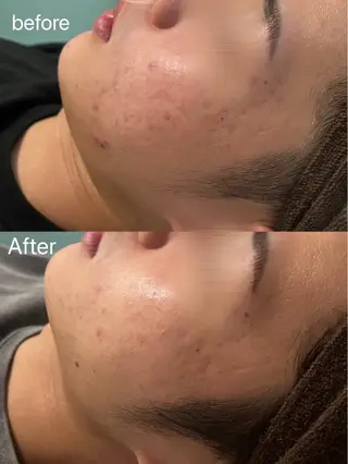 佐藤 加奈のエステ・リラクイメージ