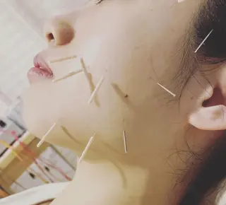 むくみたるみ専門☆ 美容鍼・小顔矯正のエステ・リラクイメージ