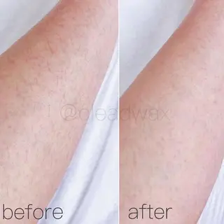 CLEAD 赤坂見附店のエステ・リラクイメージ