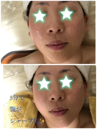 Alphaplus AYAMI のエステ・リラクイメージ