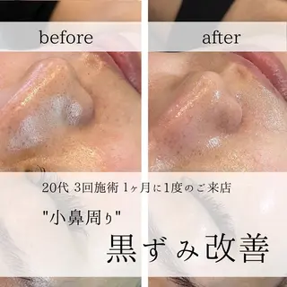 yc.hacci 【ハーブピーリング】の眉毛・アイブロウイメージ