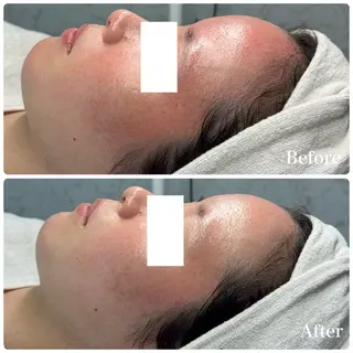 LiAm《美肌管理/ 小顔/脂肪ケア》のその他イメージ