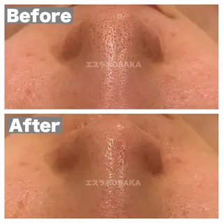 エスラボOSAKA 心斎橋のエステ・リラクイメージ