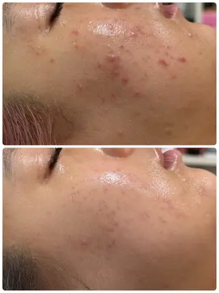 耳ツボ/体質改善/ 温活La mer月島のその他イメージ