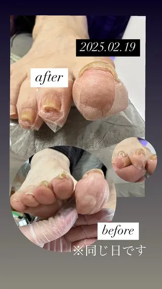 ネイル 守谷ネイル ◆UMy◆のネイルデザイン