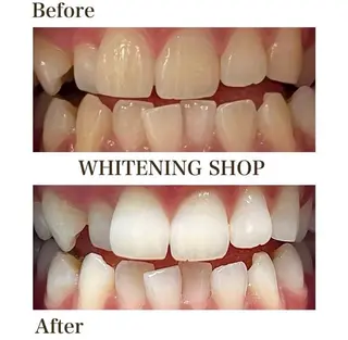 ホワイトニング ショップ伊丹店のその他イメージ